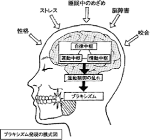 歯ぎしりの原因は