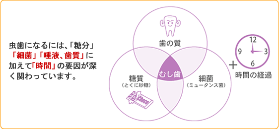 虫歯になるには、「糖分「細菌」「唾液、歯質」に加えて「時間」の要因が深く関わっています。
